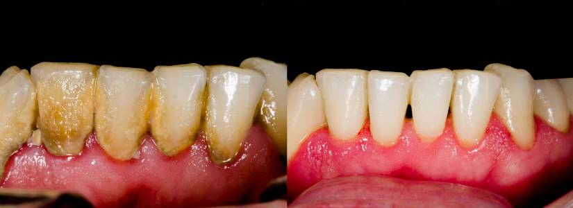 Crowborough_Dental_Hygienist
