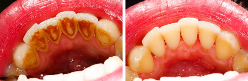 East_Sussex_Dental_Practice_Oral_Hygiene